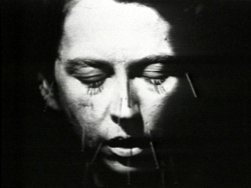 Image of Linda Montano's face covered in acupuncture needles, black and white.